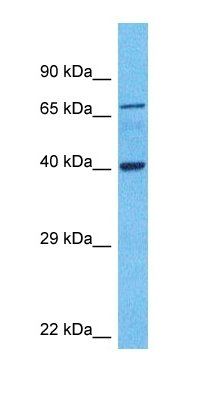 HOXD13 antibody