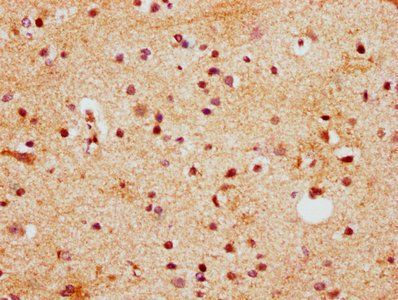 HOXD13 Antibody