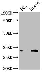 HOXD8 antibody