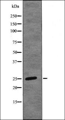 HP1-beta (Phospho-Thr51) antibody