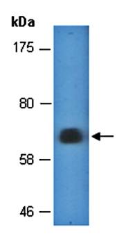 HP1BP3 antibody