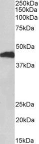 Goat anti-HP beta chain Antibody