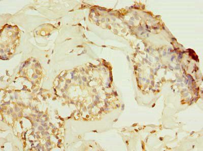 HPCAL1 Antibody