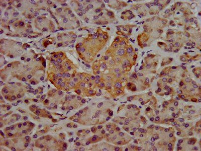 HPN Antibody