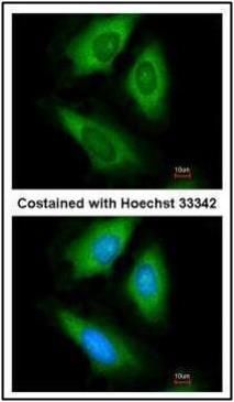 HPRT antibody