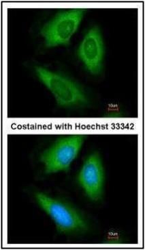 HPRT1 antibody