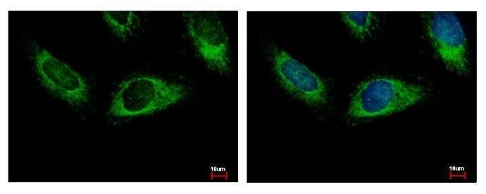 HPS3 antibody [C3], C-term