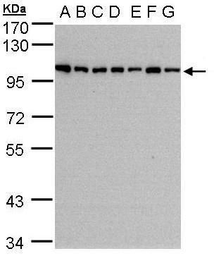 HPS3 Rabbit Polyclonal Antibody
