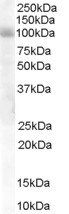 Goat anti-HPS6 Antibody
