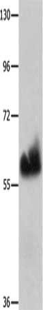 HPSE Antibody