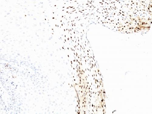 HPV-16 (Human Papilloma Virus 16) Antibody