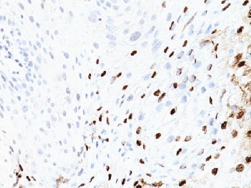 HPV-16 antibody
