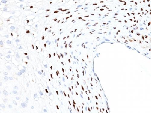 HPV-16 (Human Papilloma Virus 16) Antibody