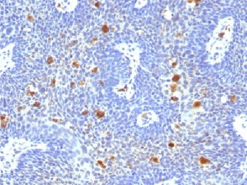 HPV-16 antibody