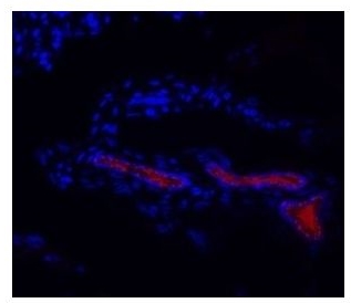 HPV-16 E6 antibody