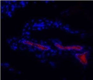 HPV-16 E6 antibody