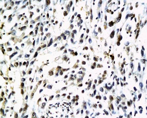 HPV18 E6 protein Rabbit Polyclonal Antibody