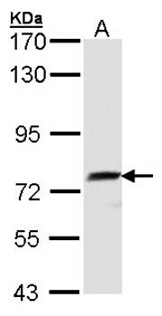 hQSOX antibody