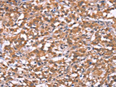 HRASLS2 Antibody