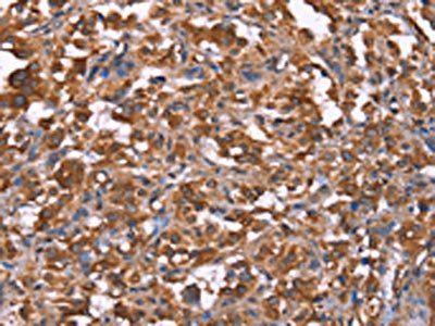 HRASLS2 Antibody