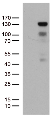 HRASLS3 (PLA2G16) antibody