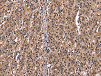 HRH1 Antibody