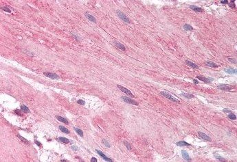Goat anti-Histamine Receptor H1 (C Term) Antibody