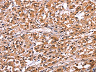 HRK Antibody