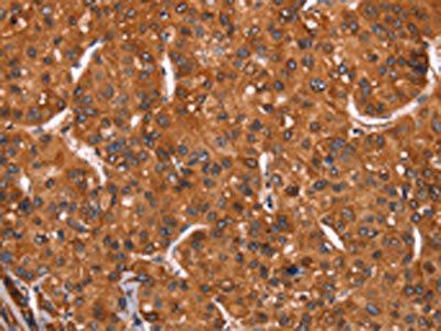 HRK Antibody