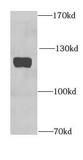 HRP 2 antibody