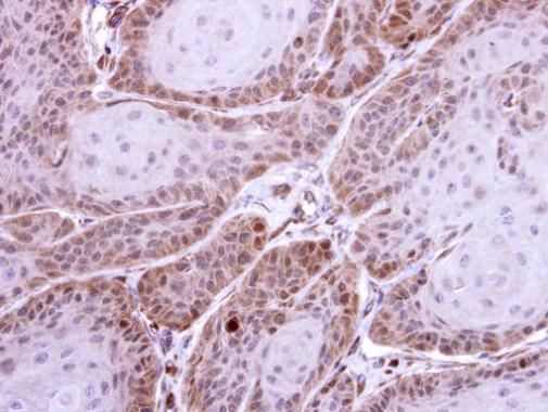 HS1BP3 antibody [C2C3], C-term