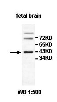 HS1BP3 Rabbit Polyclonal Antibody