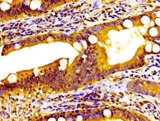 HSD11B2 Antibody