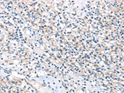 HSD11B2 Antibody