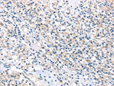 HSD11B2 antibody