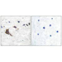 HSD17B10 Antibody