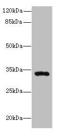 HSD17B11 antibody