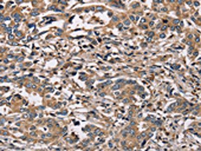 HSD17B12 Antibody