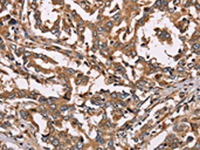 HSD17B12 Antibody