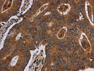 HSD17B13 Antibody