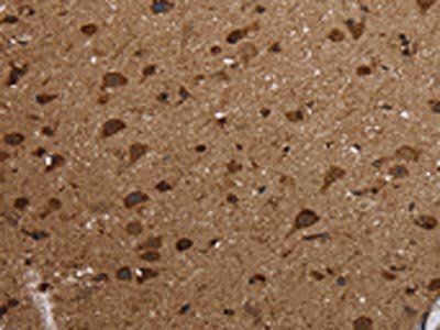 HSD17B13 Antibody