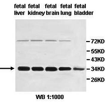 HSD17B13 antibody