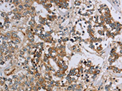 HSD17B14 Antibody