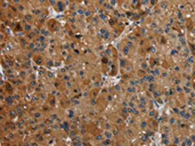 HSD17B14 Antibody