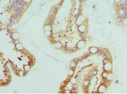 HSD17B2 Antibody
