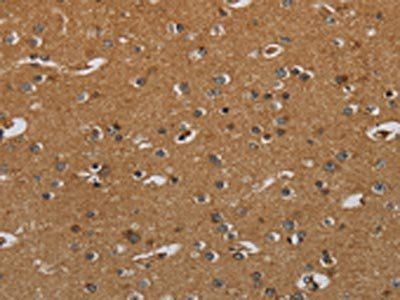 HSD17B2 Antibody