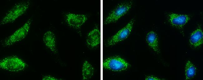 HSD17B4 Rabbit Polyclonal Antibody