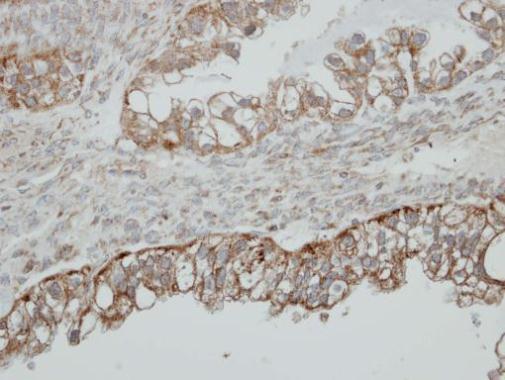 HSD17B4 Rabbit Polyclonal Antibody