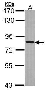 HSD17B4 Rabbit Polyclonal Antibody
