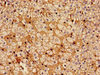 HSD17B7 Antibody